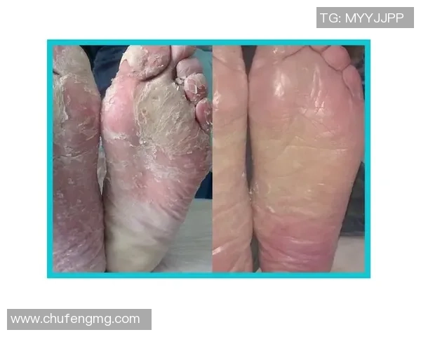 足球球星脚臭排名揭秘 哪位球员因脚臭成为队友公敌